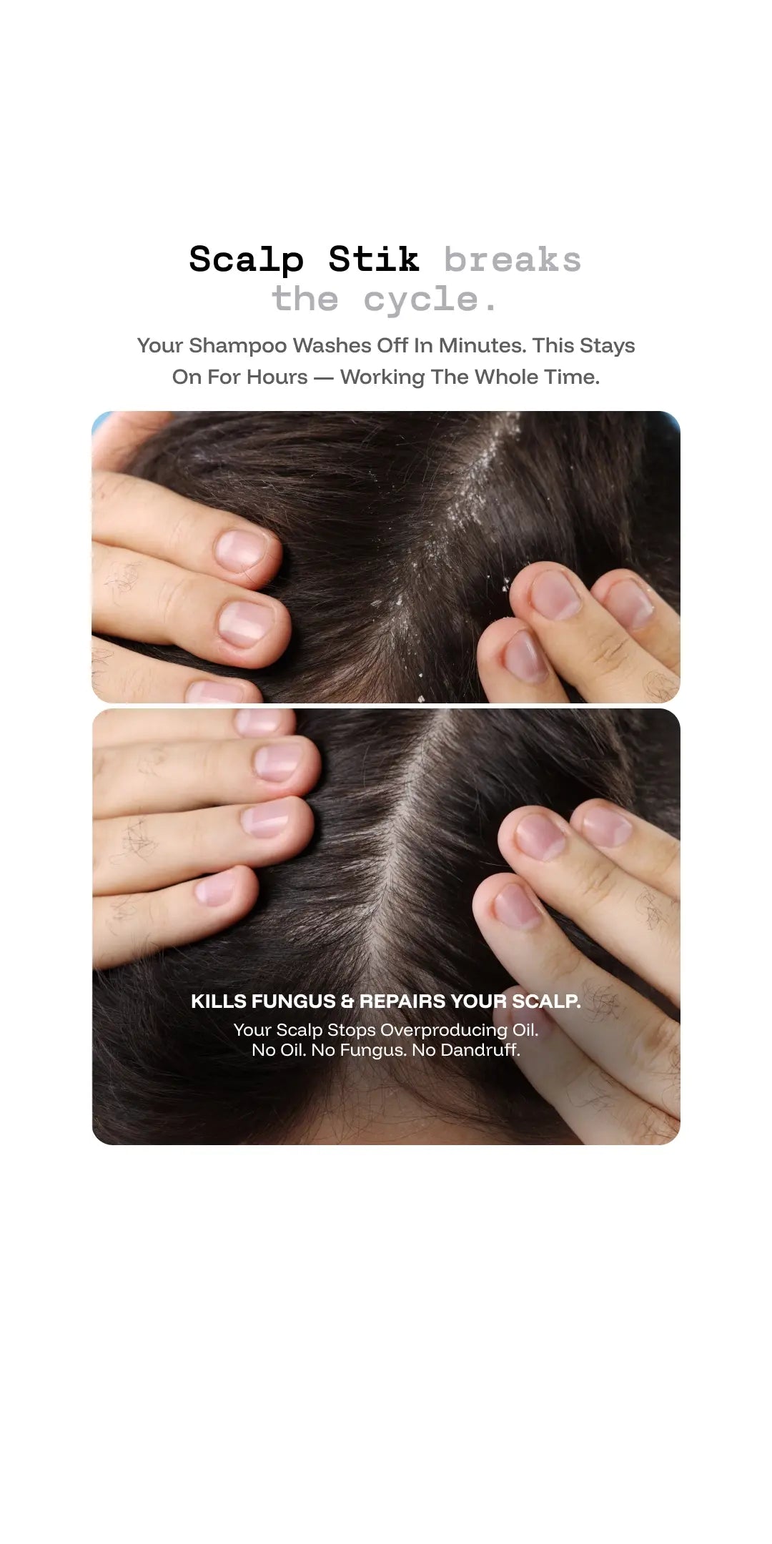 Scalp Stik