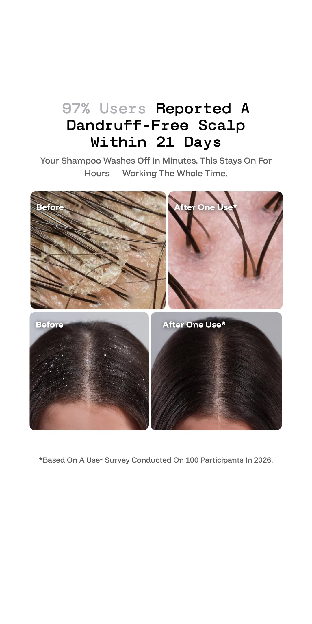 Scalp Stik