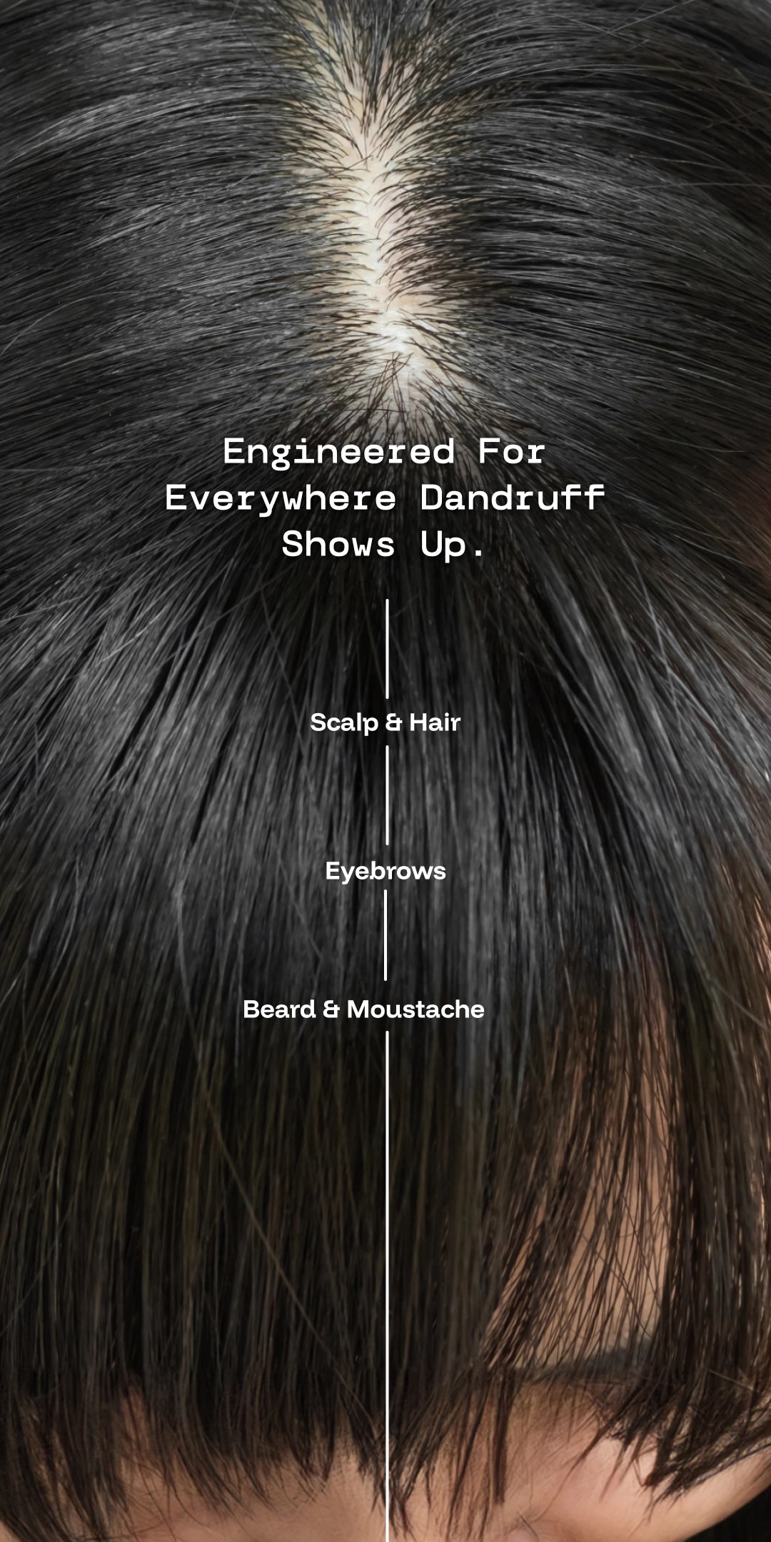 Scalp Stik