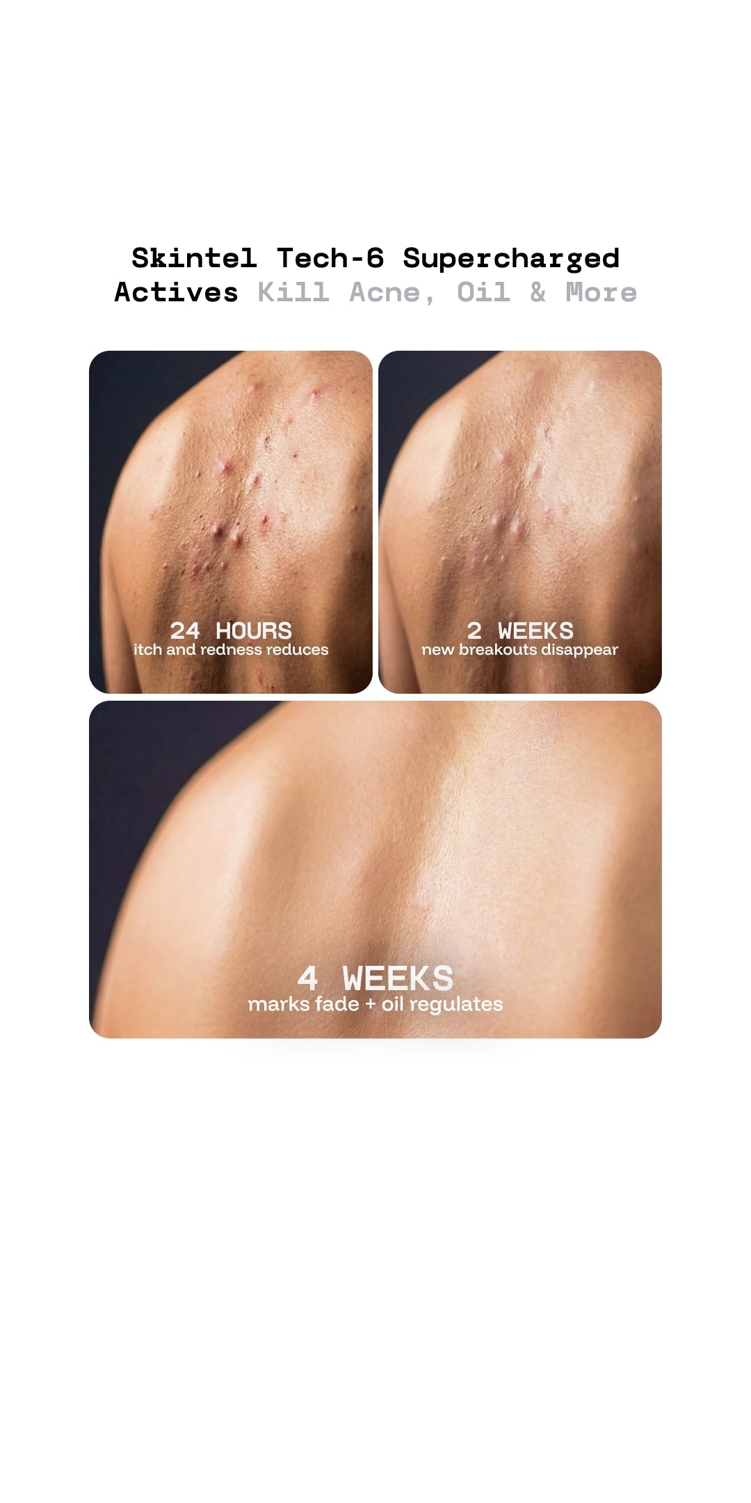 Before and after effects of Skintel Tech-6 Supercharged Actives on skin with text indicating time periods.